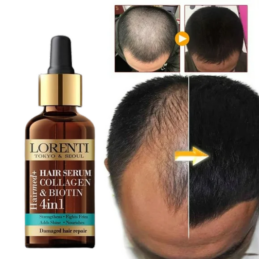 Serúm Anticaída de colágeno y Biotina: Repara, nutre y retiene la caída del cabello en tan solo semanas.
